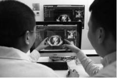 放療行業出現黑科技 人工智能加